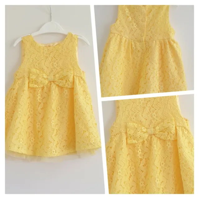 Brand New Baby Girl Yellow Lace Wedding Occasion Party Dress Size 6-9 Months