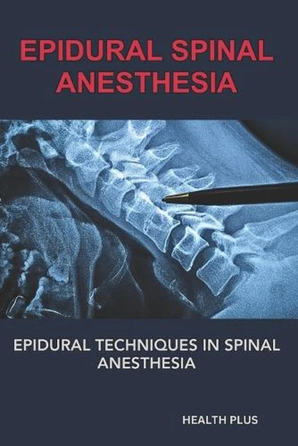 Epidural Spinal Anesthesia Epidural Techniques In Spinal Anesthesia By