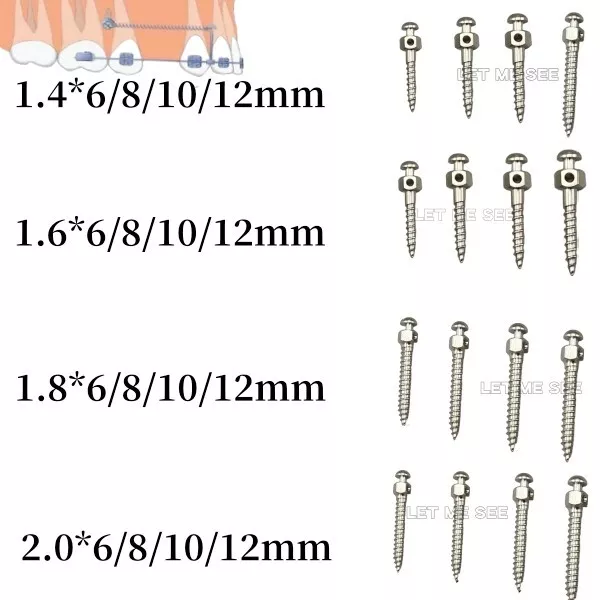 5pcs Dental Orthodontic Mini Implants Screw Titanium Alloy Micro Bone Screws