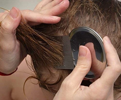 Nitty Gritty Hair Lice Nit Comb Treatment Stainless Steel Teeth & Metal Comb UK 7