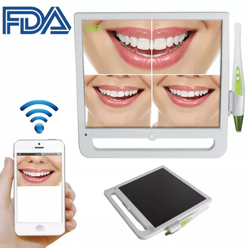 17 Inch 10M Pixels WIFI Digital LCD AIO Monitor Dental Intra oral Camera System