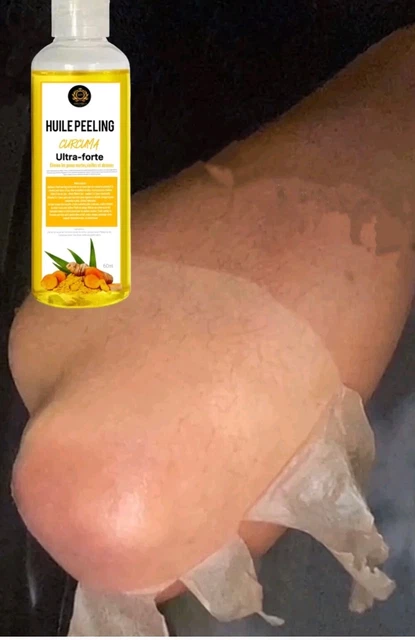 Huile Exfoliante Jaune Yollow Peeling Oil - 110 Ml - SPF4 - Pour Taches Et Cicatrices - Fabriqué En Allemagne
