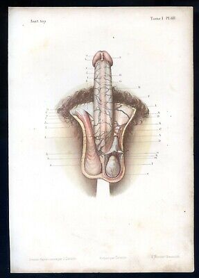 Anatomy, medicine  penile and scrotal regions..2 Antique chromolithographs .1867
