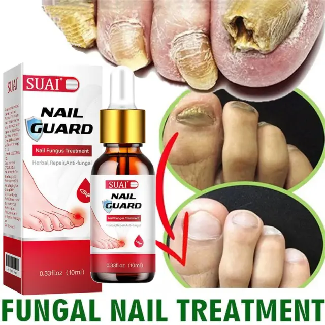 Nail Fungal Treatment Serum Anti Infection Toe Fungus Removal Gel Repair Y1E0