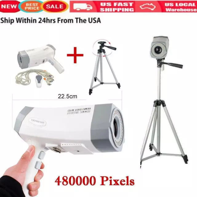 Digital Electronic Colposcope 480000 Pixels Camera Colposcopio +Tripod FDA