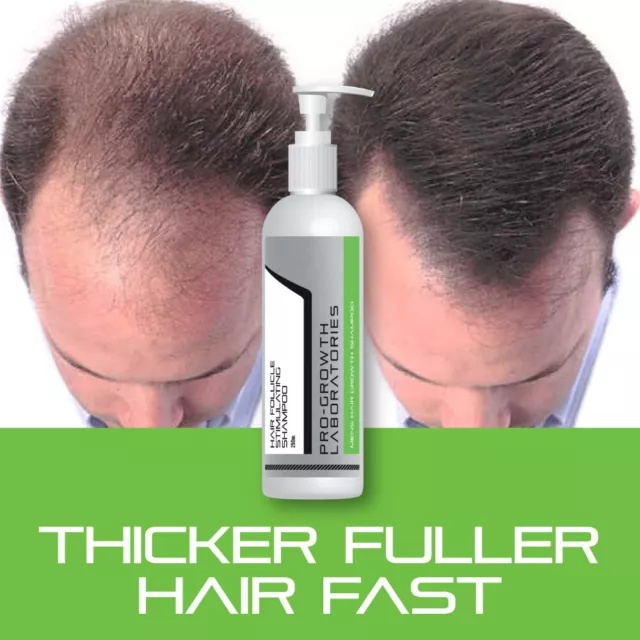 Pro Growth Mens Hair Follicle Stimulating Shampoo Hair Growth Shampoo