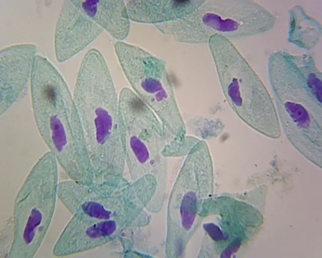 Paramecium, Macro and Micronucleus; Whole-mount by Go Science Crazy