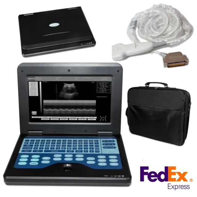 CONTEC Portable Laptop Machine Digital Ultrasound Scanner,7.5 MHZ Linear Probe