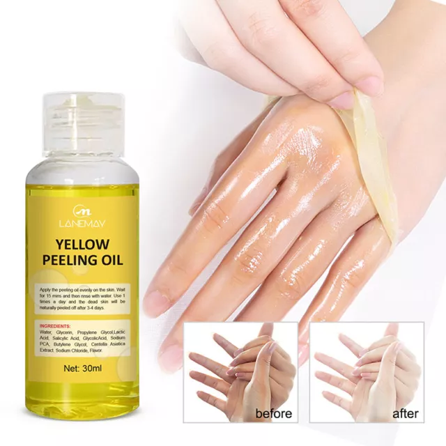 Superstarkes gelbes Peeling-Öl, aufhellendes Peeling für dunkle Haut bei FaJP