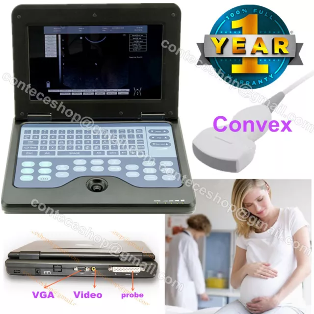Hot Full Digital Ultrasound Scanner Laptop Machine CMS600P2+Convex Probe, CE