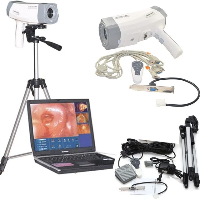 Carejoy 800,000 Pixels Video Electronic Colposcope Camera Software W/+ Tripod
