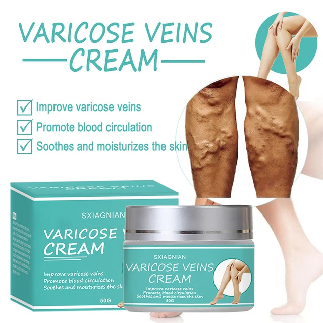 VARICOSE VEINS OINTMENT Vasculitis Legs Phlebitis Treatment Cream Pain