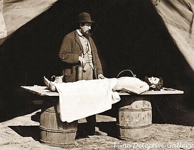 Civil War Surgeon Embalming a Union Soldier's Body - Historic Photo Print
