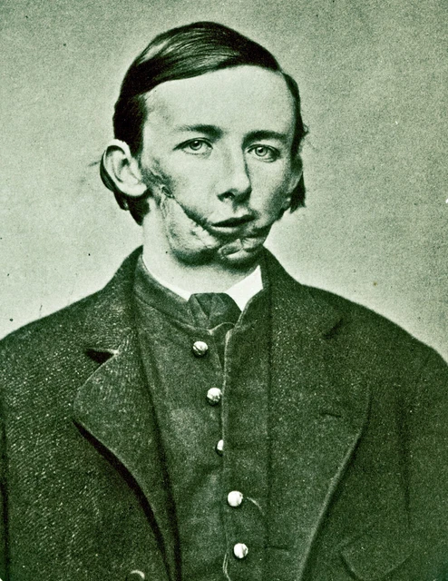 Antique Civil War Medical Photo 551b Oddleys Strange & Bizarre 2