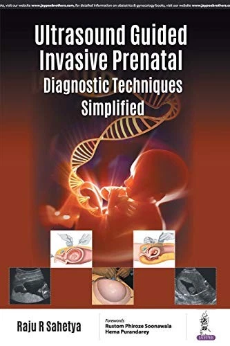 Snk Raju 37 ULTRASOUND GUIDED INVASIVE Prenatal Diagnostic Techniques Simplified by ...