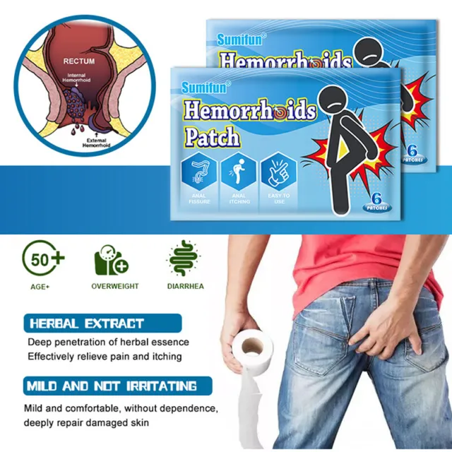 6pcs Hemorrhoids Patch External Hemorrhoid Removal Ointment Plaster Patch A`eo