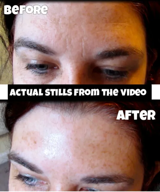 WATCH OUR AMAZING VIDEO Instant Facelift remove reduce deep wrinkles cream serum 2