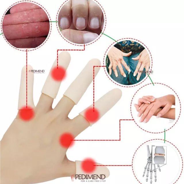 PEDIMEND™ Silikon Gel Fingerschutz für rissige und trockene Fingerhaut & Nägel 3