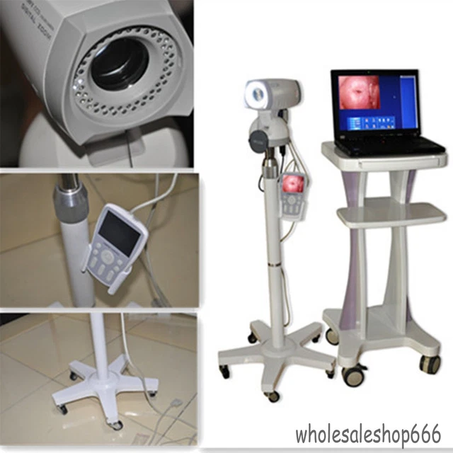 Camera 830,000 Pixels CCD +Digital Video Electronic Colposcope Endo Machine