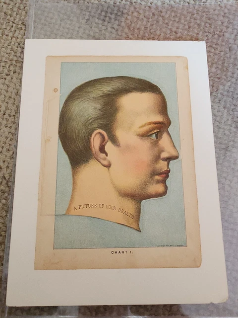 1901 E J Stanley 4 Lyr Hinged Color Litho Anatomical/Dissected Illust Human Head