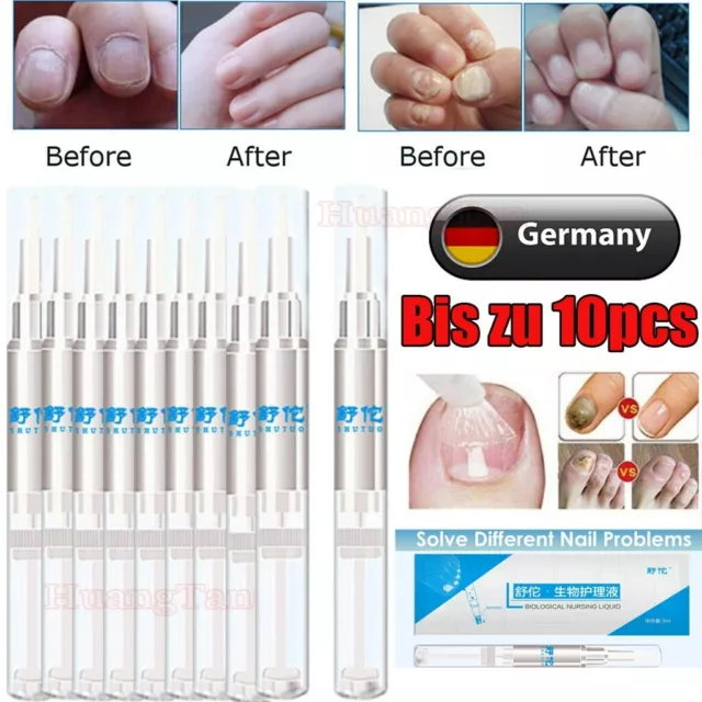 10/8 Pack Anti Nagelpilz Stift - Pilz Behandlung - Entfernung Von Nagelpilz 3ml
