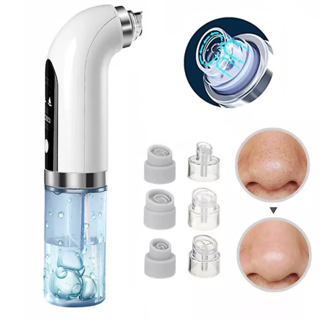 Electric Micro Bubble Blackhead Remover Vacuum Acne Pore Facial Suction Cleaner