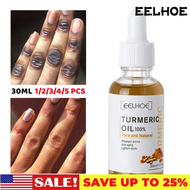 1-5PCS Turmeric Face Serum Oil Whitening Ance blemish Dark Spot Corrector Cream