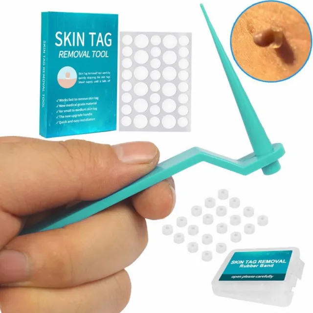 Kit de banda de anillos de goma fácil y seguro para etiquetas de piel