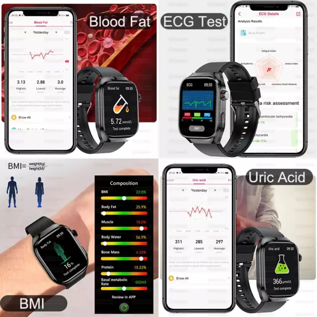 2025 NEW ECG Smart Watch Women BT Call Heart Rate Blood lipids Uric