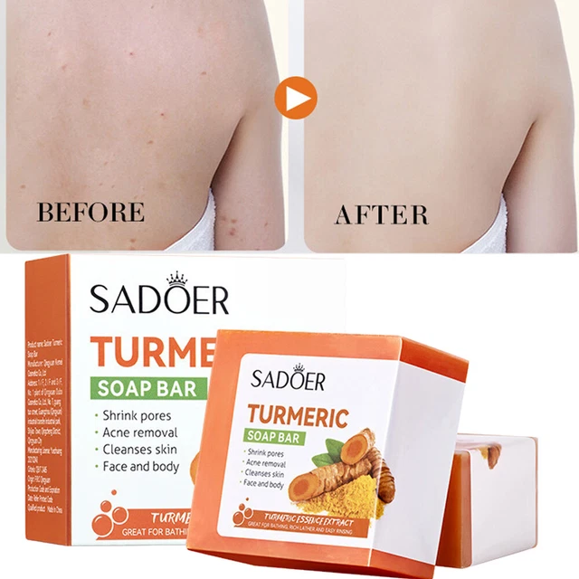Savon J+1 Ultra Blanchissant Anti-imperfections - À Base De L-Glutathion - 160 G - Fabriqué En France - Neuf
