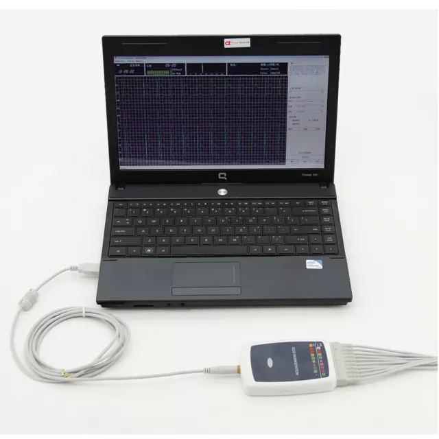 Système de station de travail ECG, machine d'électrocardiogramme de repos 2