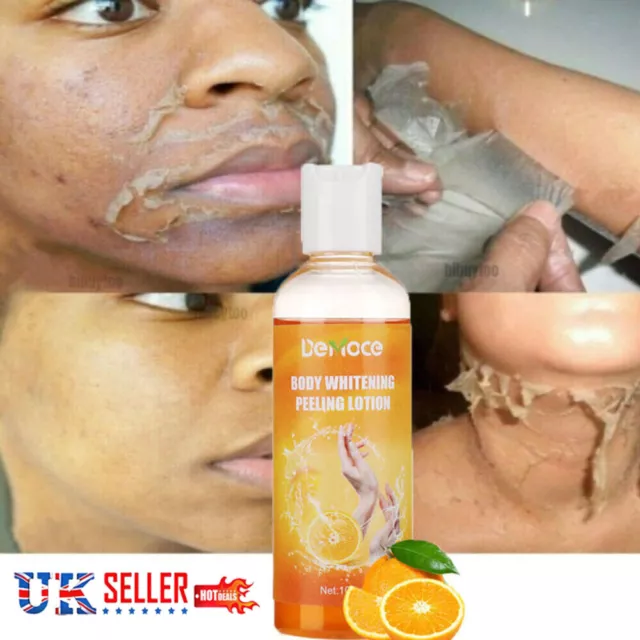 Orange Peel Peeling Lotion Face Body Dark Skin Whitening Cream Brightening Gel