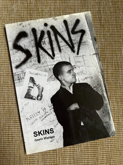 Skins Gavin Watson （First Edition） Buy Skins by Gavin Watson Online – Setanta Books