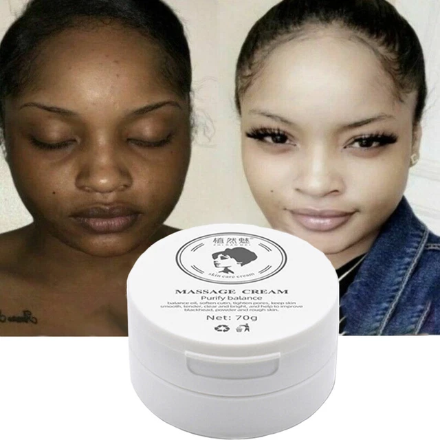 FAST DARK SKIN Permanent Bleaching Cream Whitening Lightening Brightening Purify EUR 5,99