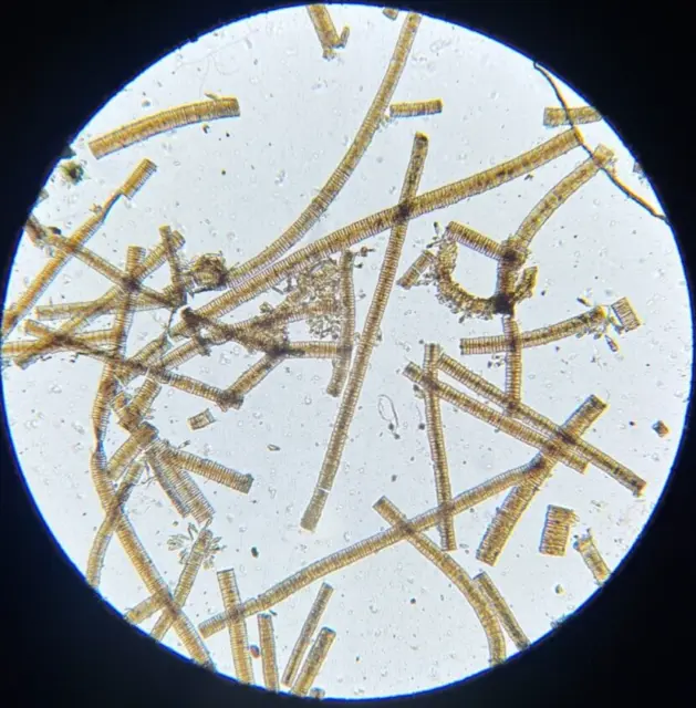 19th c J.D. Moller Microscope Slide Diatom Norway Grammonema Striatulum Ag.