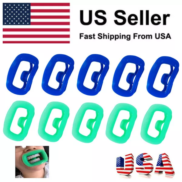 Dental Ortho Mouth Opener Teeth Whitening 3D Silicone Cheek Retractor for Adult