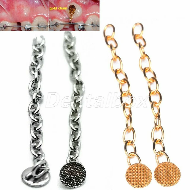 Dental Orthodontic Traction Button Chain Round Silver/Gold Plated 2pc/Bag