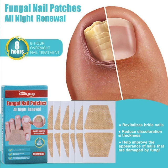 16 Parches Tratamiento Antifúngico Uñas Puntera-Hongos Onicomicosis Reparación Sti MEJOR