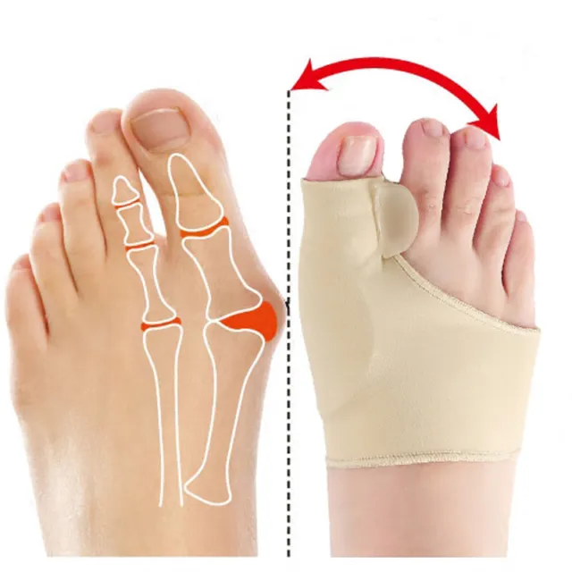 Big Toe Bunion Corrector Splint Straightener Valgus Pain Relief  Big Bone Orthop