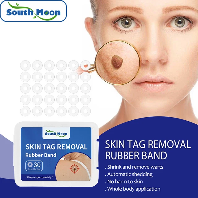 Removedor de verrugas de goma fácil de usar removedor de manchas de lunares cuidado facial herramientas de belleza