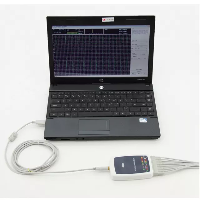 Stazione di lavoro ECG ECG a 12 derivazioni Software per PC USB Analysis Machine 2