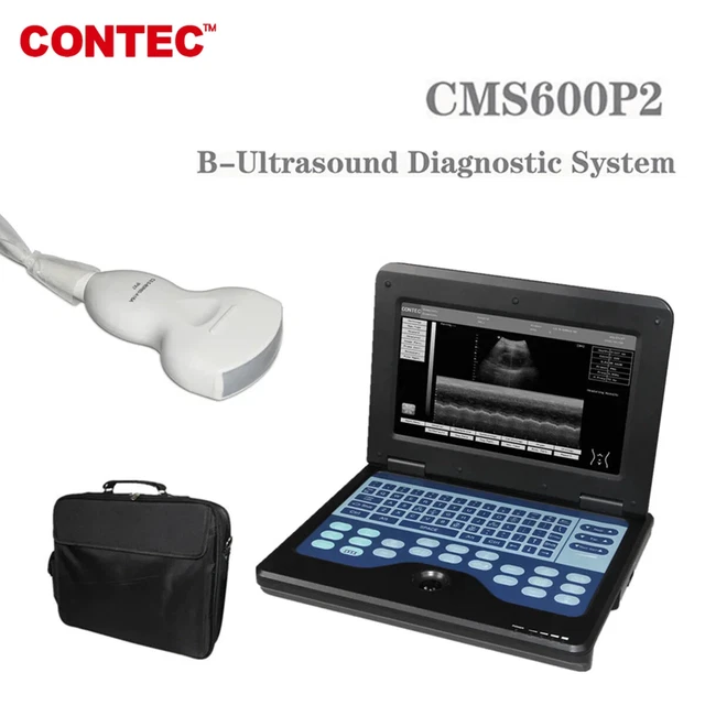 CONTEC CMS600P2VET Portable Digital Ultrasound Scanner Machine CONTEC CMS600P2VET Portable Digital Ultrasound Scanner Machine