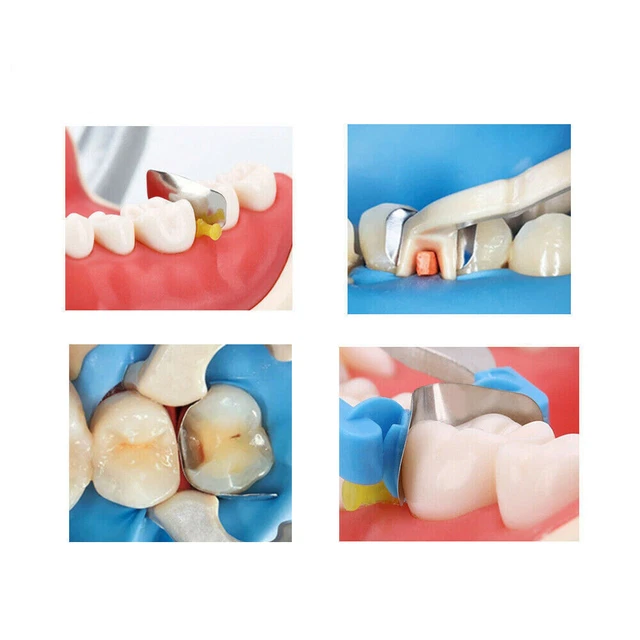 Dental Matrix Bands Ring Sectional Matrice Clamp Fit V3 System