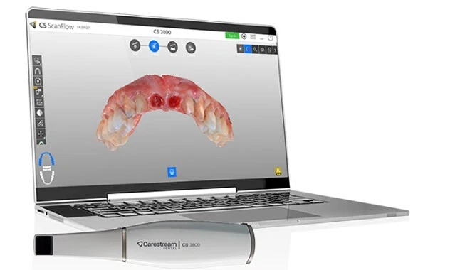 Carestream CS3800