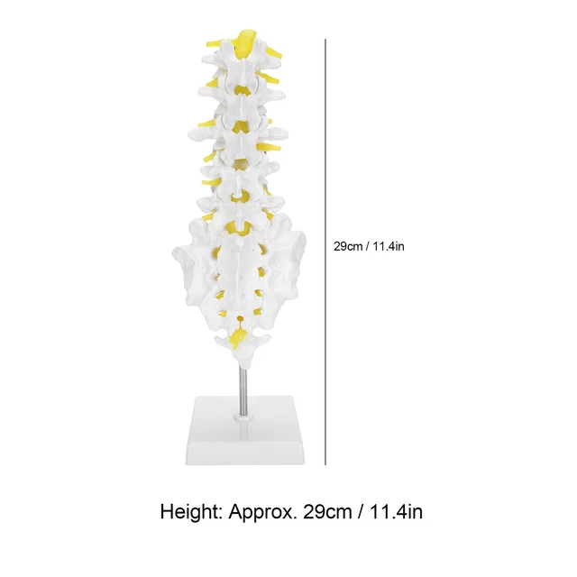 HUMAN LUMBAR SPINE Demonstration Model Lumbar Vertebral Model Widely ...