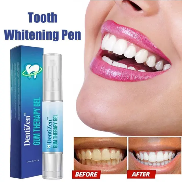 Pluma removedora blanca de gel blanqueador dental terapia de goma dentizen venta instantánea