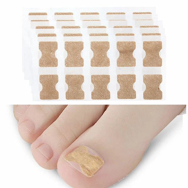 50PCS PARONYCHIA TOENAIL Treatment Tape Ingrown Toenail Tape Correction