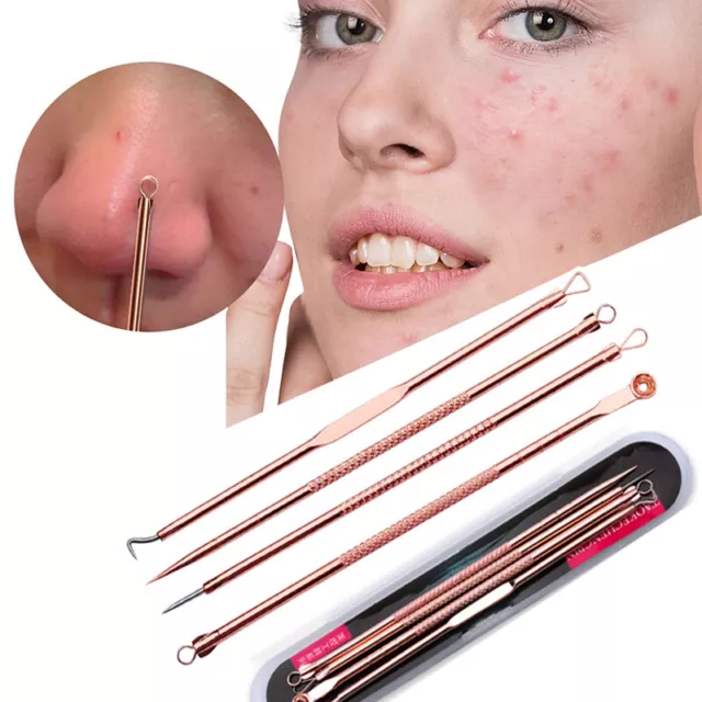 Aghi per acne aghi per raccolta 4 pezzi rimozione punti neri strumenti di bellezza oro rosa ⌒