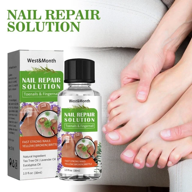 Uñas engrosadas uñas de los pies solución reparación de uñas de los pies uñas tratamiento de hongos