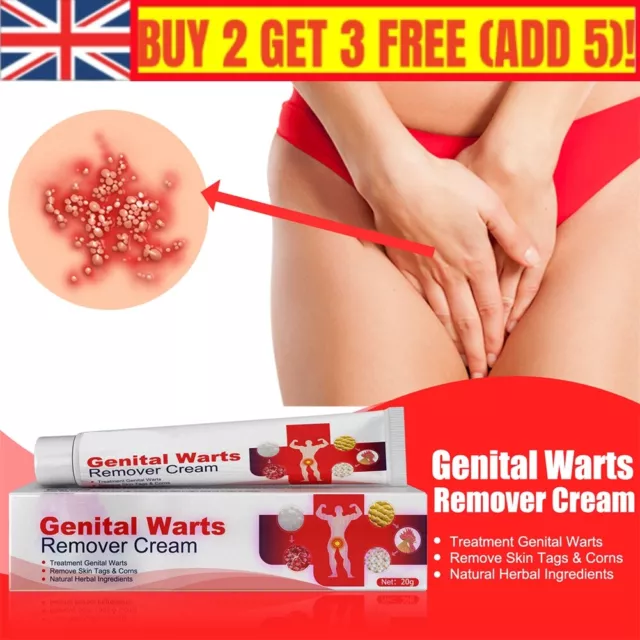 Genital Herpes Wart Remover Ointment Skin Tag Mole Acuminatum Treatment Cream